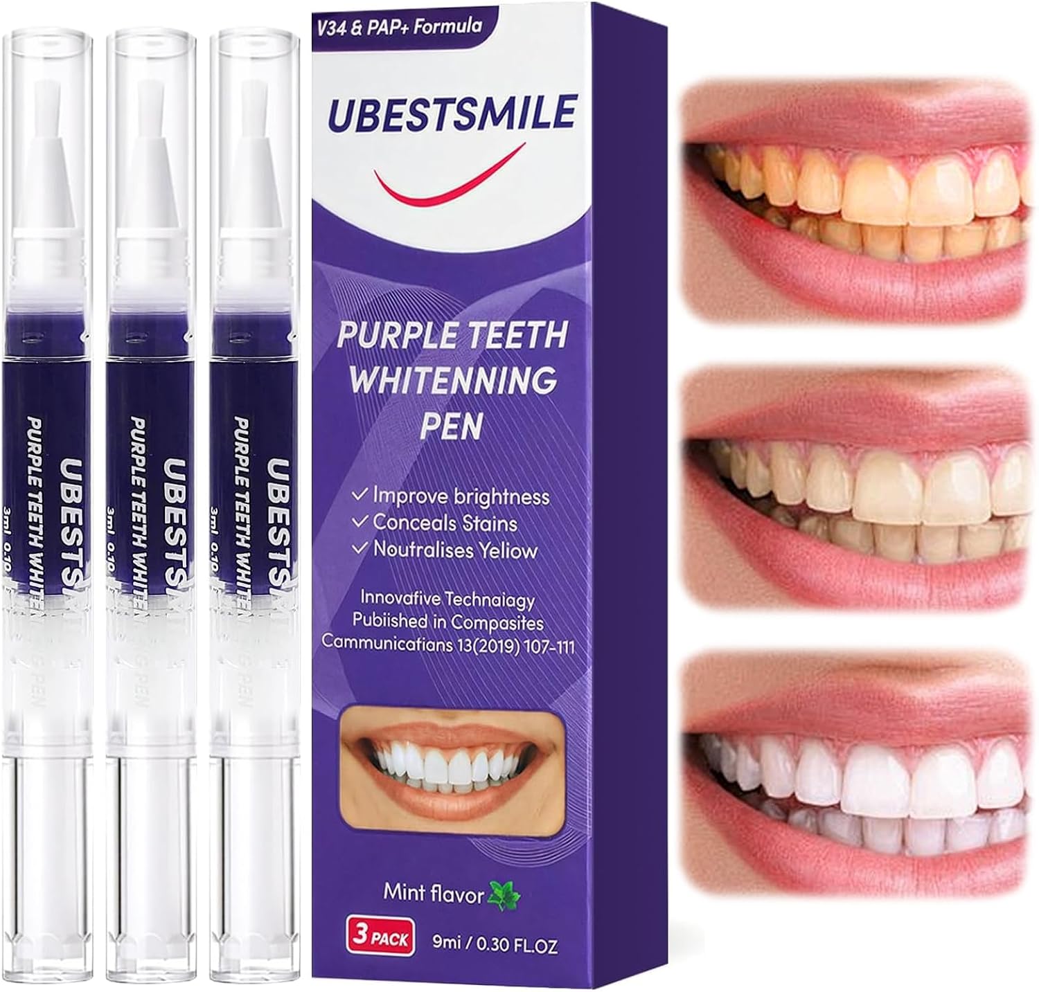 UBESTSMILE V34&PAP+ Formula Li – Teeth Whitening Pens Bewertung und Preis