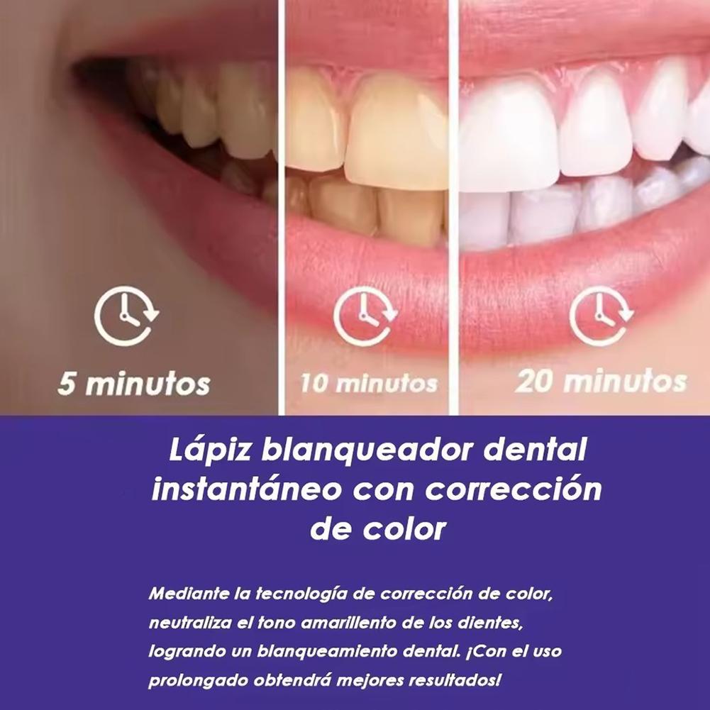 UBESTSMILE V34&PAP+ Formula Li – Teeth Whitening Pens Bewertung und Preis