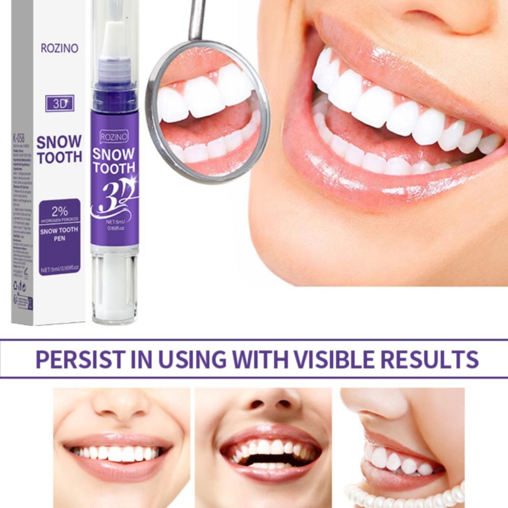 3D-Schnee-Zahnaufhellungsstift – Teeth Whitening Near Me Bewertung und Preis